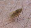 Aphrodes (bicinctus-makarovi)